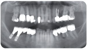 Biologische Zahnmedizin Panoramaröntgenaufnahme