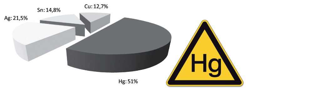 Exemplarische Zusammensetzung einer Amalgamfüllung: 51% Quecksilber (Hg), 21,5 % Silber (Ag), 14,8 % Zinn (Sn) und 12,7 % Kupfer (Cu) (nach Herstellerangaben). 