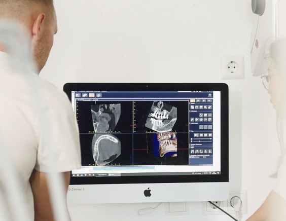 Metal-free ceramic implants